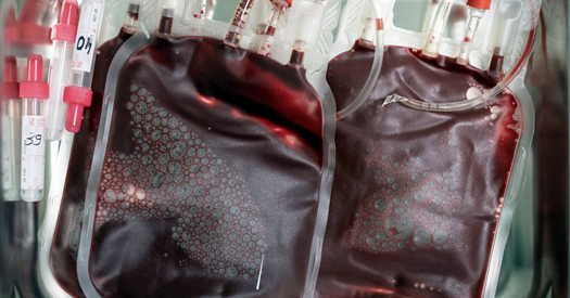 Autismo: Por que a Hype das Terapias com Células-Tronco Persiste?