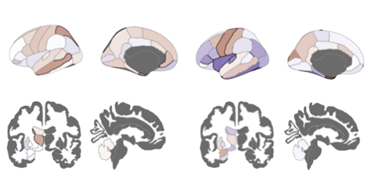 Mudanças Cerebrais Estruturais em Modelo de Camundongo com Síndrome ATR-X: Descubra Mais!